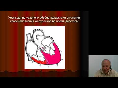 Видео: Поликлиническая терапия 1.Хроническая сердечная недостаточность