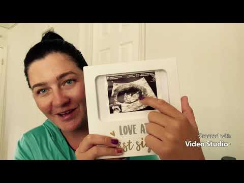 Видео: Я беременна ❤️🤰🏻. 6-11 неделя Беременности . Токсикоз /Узи/кровотечения - но все прекрасно ❤️