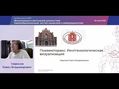 Видео: Рентгенодиагностика пневмоторакса