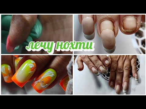 Видео: Новая клиентка 👀 с грибками 💩 Простой и быстрый дизайн 