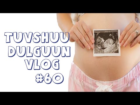 Видео: Анх удаа жирэмсний ЭХО-д харуулав