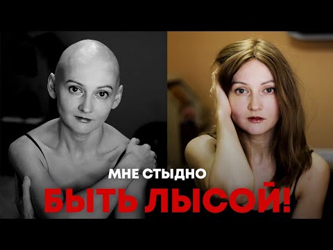 Видео: «Я – урод». Алопеция — приговор для женщины?