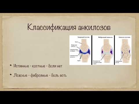 Видео: 2.24. Контрактуры и анкилозы. Классификация, этиология. Лечение.