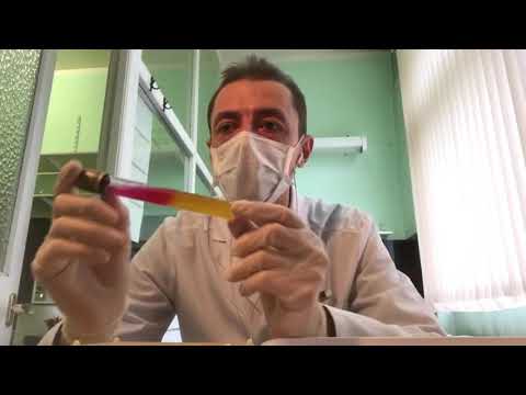 Видео: Как распознать бактерии рода Shigella (шигелла). Подробный лабораторный обзор (2020).