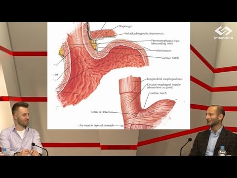 Видео: Вялов С.С., Абрамов О.С. Рефлюксная болезнь: ГЭРБ, ДГР и ЛТР