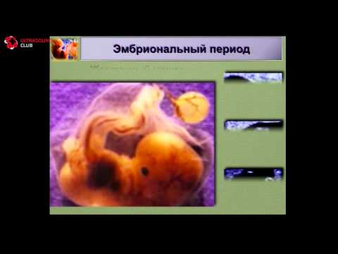 Видео: Эмбриональный период -- современный взгляд - А.Ю. Блинов