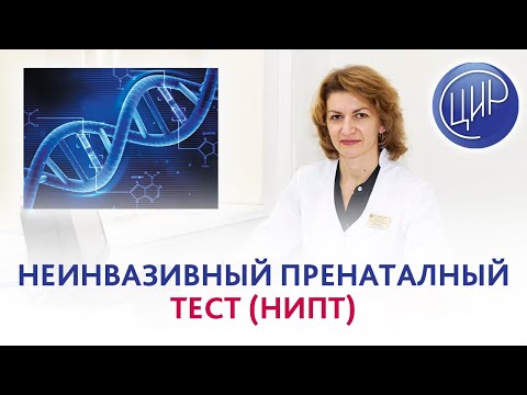 Видео: Неинвазивный пренатальный тест (НИПТ) и хромосомные аномалии плода. Дементьева С.Н.