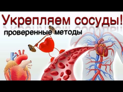 Видео: Укрепление сосудов. Флеболог Москва.