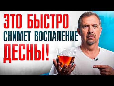 Видео: Кровоточат дёсны? Эти ошибки могут стоить вам зубов!