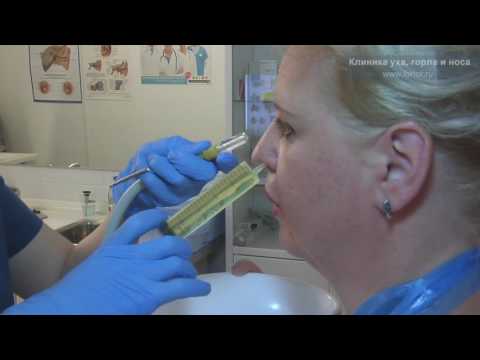 Видео: Промывание носа