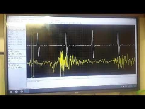 Видео: Троение дизельного двигателя Fiat Doblo