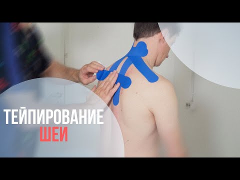 Видео: ЭКСТРЕННАЯ ПОМОЩЬ ПРИ БОЛИ В ШЕЕ, ТЕЙПИРОВАНИЕ МЫШЦ ШЕЙНОГО ОТДЕЛА ПОЗВОНОЧНИКА