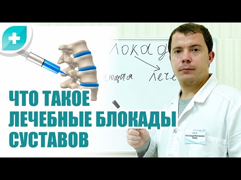Видео: Что такое лечебная блокада суставов