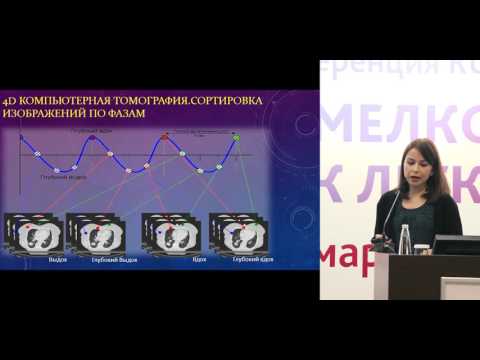 Видео: Методы учета дыхательных движений при радиотерапии рака легкого