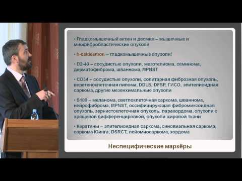 Видео: Савёлов Н.А., - Саркомы мягких тканей: общие принципы морфологической диагностики.