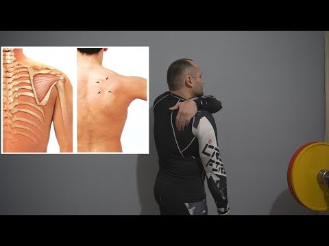 Видео: Боль в передней части плеча/коварная подостная мышца