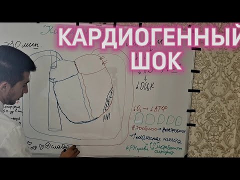 Видео: КАРДИОГЕННЫЙ ШОК