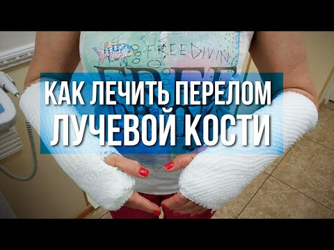 Видео: Как лечить перелом лучевой кости?