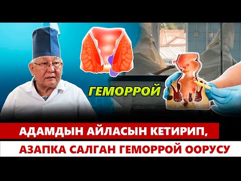 Видео: Адамдын айласын кетирип, азапка салган геморрой оорусу