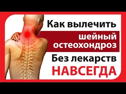 Видео: Шейный остеохондроз. Как лечить?