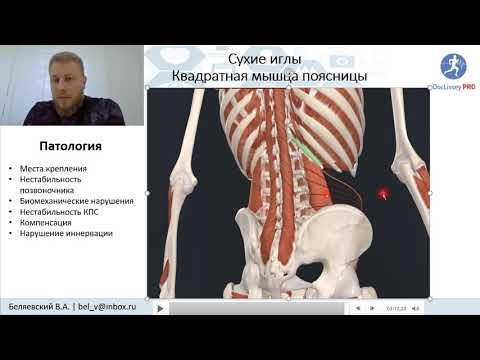 Видео: Иглоукалывание в квадратную мышцу поясницы