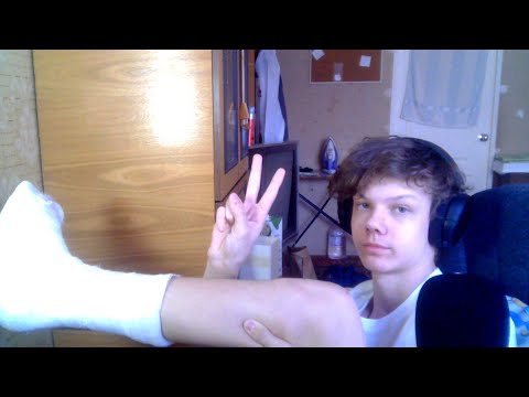 Видео: я сломал ногу.