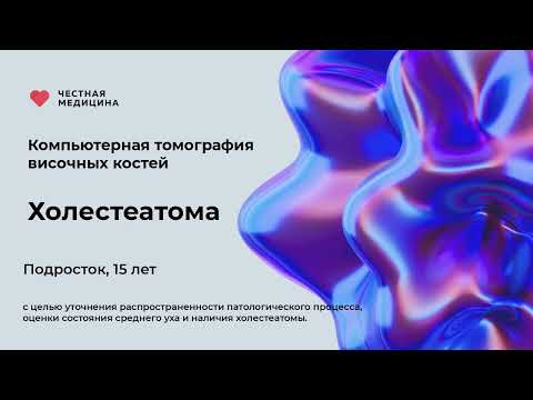 Видео: Компьютерная томография височных костей Холестеатома