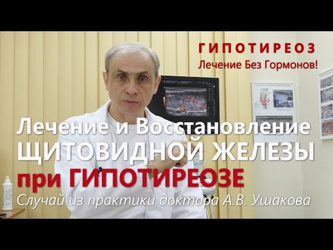 Видео: Гипотиреоз: Лечение без гормонов Щитовидной железы. Пример случая из практики || Доктор Ушаков