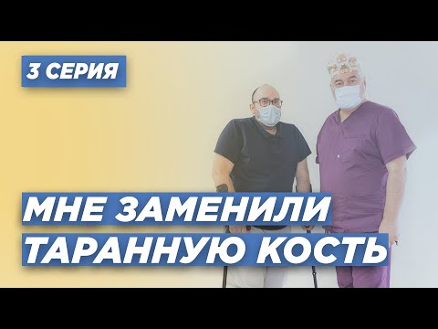 Видео: ИСТОРИЯ ПАЦИЕНТА: МНЕ ЗАМЕНИЛИ ТАРАННУЮ КОСТЬ - 3 СЕРИЯ. КАК ЗА ГОД ПОСТАВИТЬ ПАЦИЕНТА НА НОГИ.