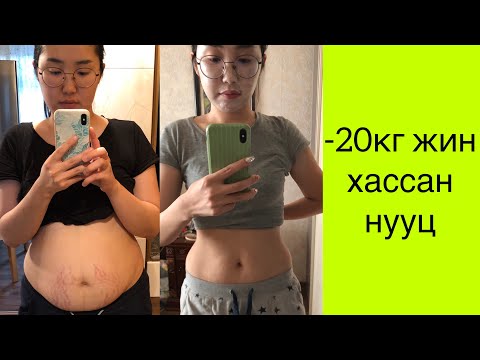 Видео: Төрсний дараах -20кг жин хассан нууц