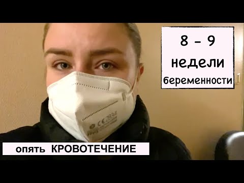 Видео: 8-9 НЕДЕЛЯ БЕРЕМЕННОСТИ // СНОВА КРОВОТЕЧЕНИЕ // УГРОЗА ВЫКИДЫША // СТРАШНО ПОТЕРЯТЬ РЕБЕНКА