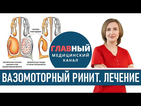 Видео: Вазомоторный Ринит: симптомы и лечение. Как лечить заложенность носа без насморка