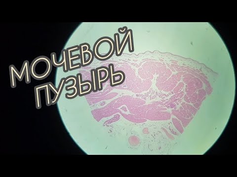Видео: МОЧЕВОЙ ПУЗЫРЬ