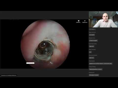 Видео: Инородные тела дыхательных путей и ЖКТ - А.С. Задвернюк