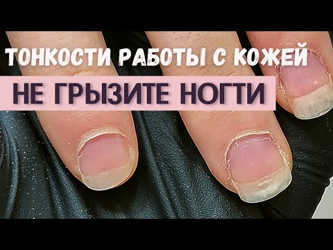Видео: Маникюр сложные руки 🤚 Сложная кутикула 🤚 Ногти грызуна