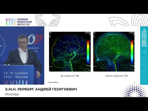 Видео: Регионарное лечение пациентов с глиобластомой G4: первый клинический опыт