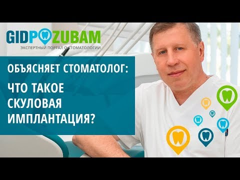 Видео: Как проводится скуловая имплантация за 1 день ❓ Объясняет эксперт-имплантолог