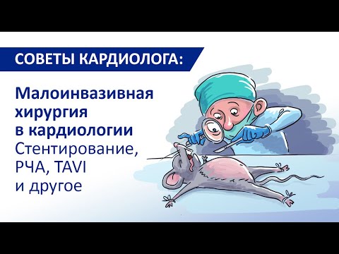 Видео: Советы кардиолога: Малоинвазивные хирургические вмешательства в кардиологии