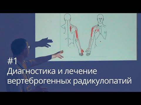 Видео: Диагностика и лечение вертеброгенных радикулопатий (часть 1)