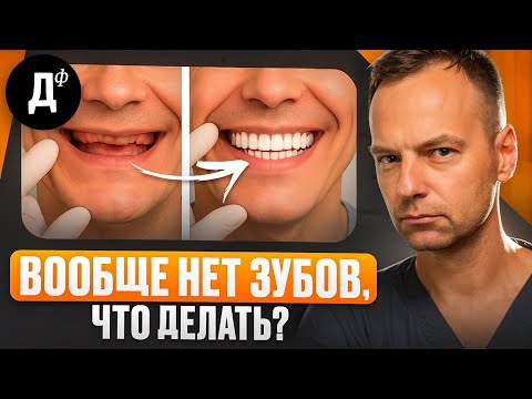 Видео: Если у вас не осталось зубов, ДЕЛАЙТЕ ЭТО! Можно ли поставить импланты на все зубы?