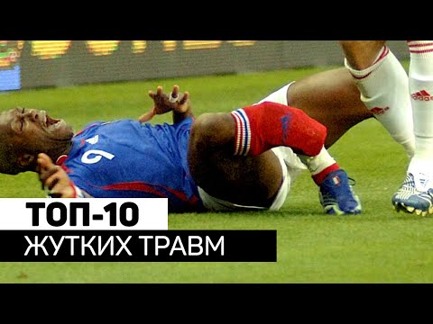 Видео: Самые ЖУТКИЕ травмы футболистов. Футбольный топ. @120 Ярдов