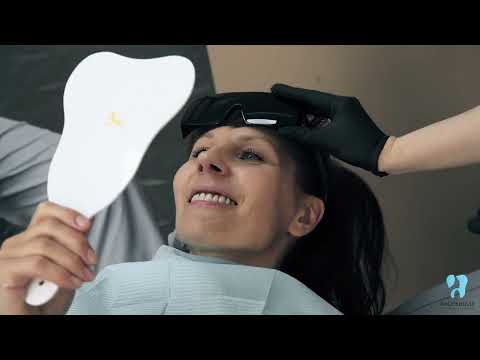 Видео: All-on-4 имплантация зубов. Отзыв клиента.