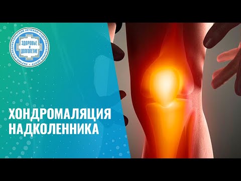 Видео: 🦵 Хондромаляция надколенника или отсроченный гонартроз