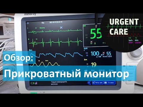 Видео: Обзор оборудования "Mindray". Прикроватный монитор пациента