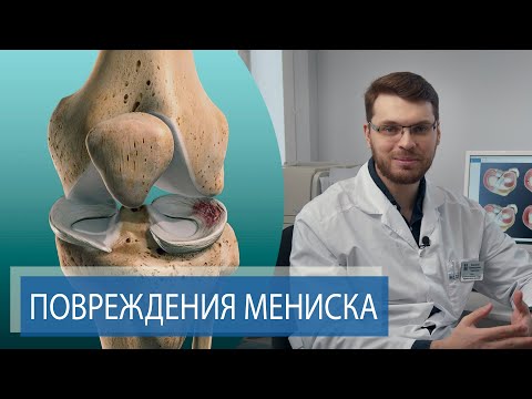 Видео: ТРАВМА МЕНИСКА | Боль и хруст в колене