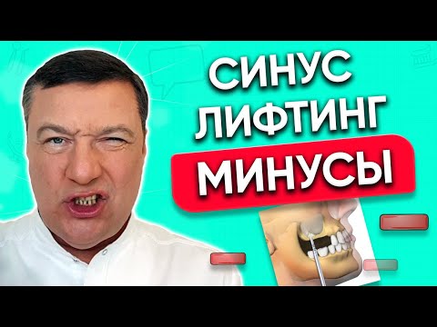 Видео: Синус лифтинг верхней челюсти МИНУСЫ