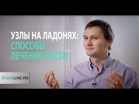 Видео: Контрактура Дюпюитрена: что делать, когда на ладони появляются узлы и пальцы рук не разгибаются?