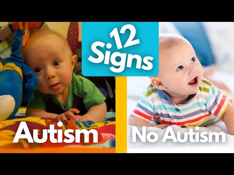 Видео: 12 ранних признаков аутизма у младенцев, которые вы могли пропустить