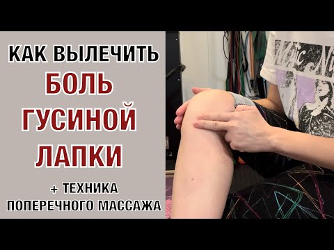 Видео: Боль ГУСИНОЙ ЛАПКИ. Комплекс упражнений + техника ПОПЕРЕЧНОГО МАССАЖА.