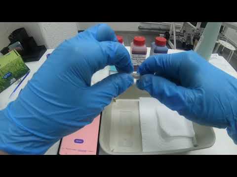 Видео: окраска мазков методом дифф - квик ( Diff - quick )